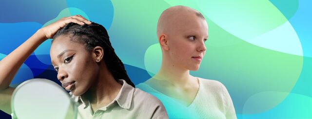 Adjusting to Life With Alopecia image